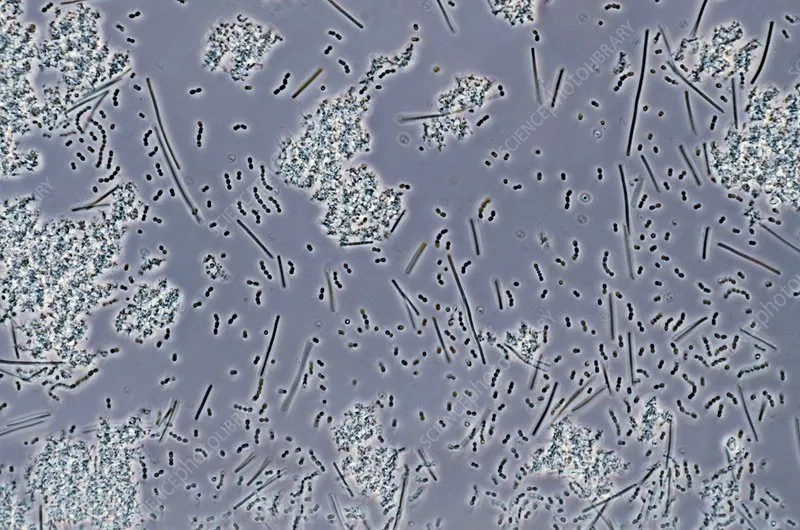 Vi khuẩn Lactic đóng vai trò quan trọng trong việc ức chế các tác nhân gây mùi